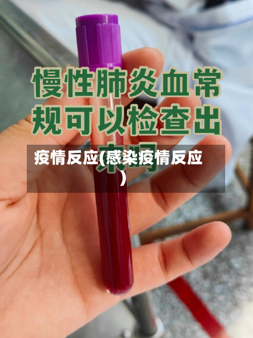 疫情反应(感染疫情反应)